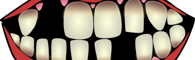 How Long Does It Take To Recover From A Dental Implant?