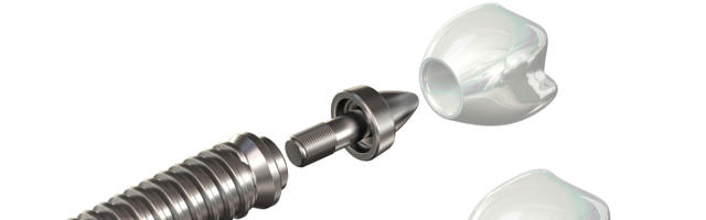 Dental Implants Abroad Don’t Have To Be Complicated