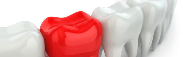 Tooth Replacement Options