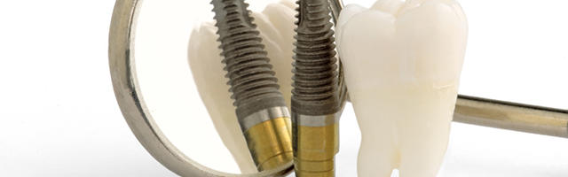 Dental implant rejection