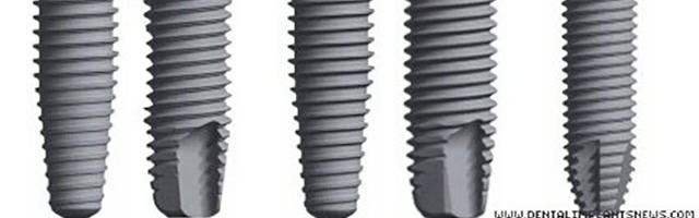 A Closer Look At Nobel Biocare’s TiUnite Surface