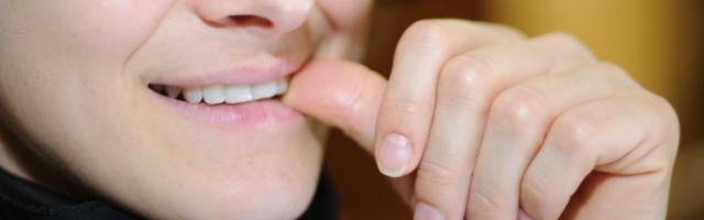 Gums Discoloured From Dental Crowns