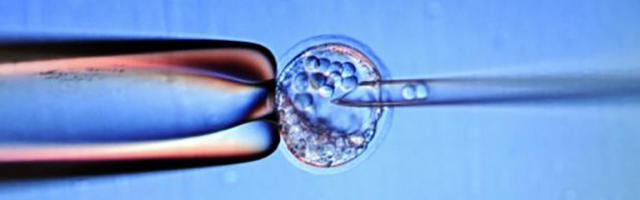 How Stem Cells Will Change Medical Tourism