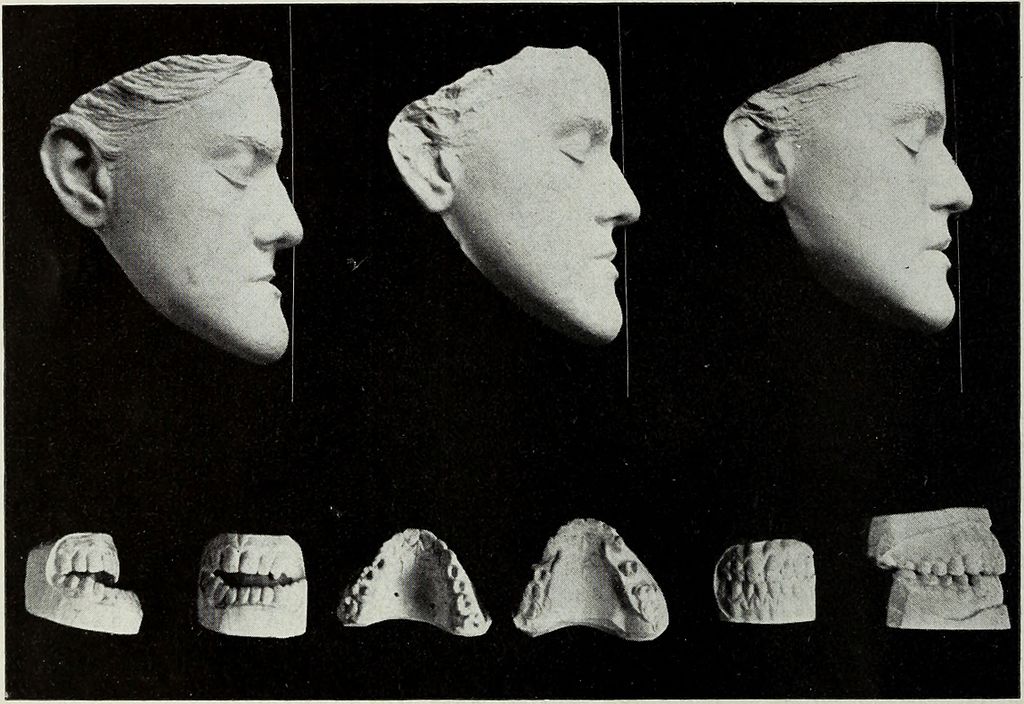 orthodontic changes